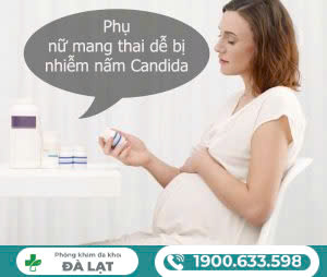 Hình ảnh minh họa